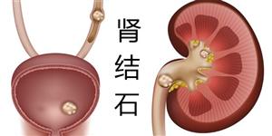 谁说中医只能治慢病 —跟随苏礼教授门诊札记之十九